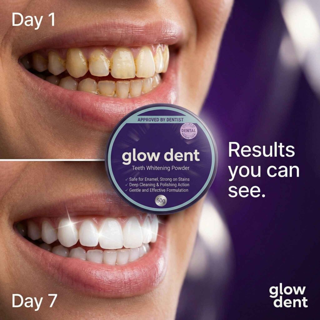 Advanced Home Teeth Whitening Tips for Sensitive Gums